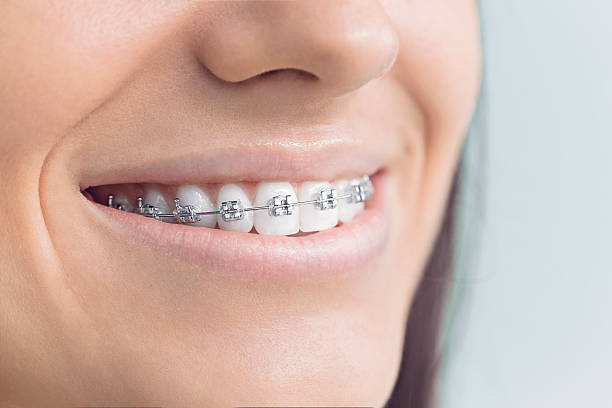 Best Teeth Whitening  in Wolf Lake, MI